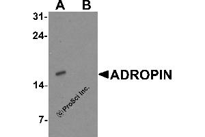 Western Blotting (WB) image for anti-Energy Homeostasis Associated (ENHO) (C-Term) antibody (ABIN2457882) (ENHO antibody  (C-Term))