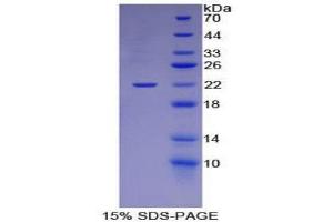 SDS-PAGE (SDS) image for Laminin, alpha 1 (LAMA1) (AA 2640-2773) protein (His tag) (ABIN1525499) (Laminin alpha 1 Protein (AA 2640-2773) (His tag))