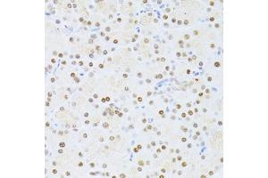 Immunohistochemistry of paraffin-embedded rat pancreas using ETV1 antibody (ABIN6129794, ABIN6140327, ABIN6140329 and ABIN6217250) at dilution of 1:100 (40x lens). (ETV1 antibody  (AA 80-300))