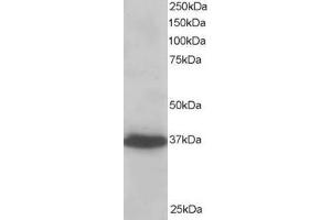 Western Blotting (WB) image for anti-PDZ and LIM Domain 4 (PDLIM4) antibody (ABIN5923210)
