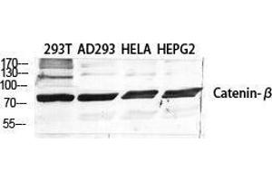 Western Blot (WB) analysis of specific cells using Catenin-beta Polyclonal Antibody. (beta Catenin antibody  (Ser289))