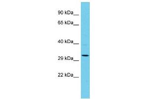 Host: Rabbit Target Name: AP1AR Sample Type: Jurkat Whole Cell lysates Antibody Dilution: 1. (AP1AR antibody  (C-Term))