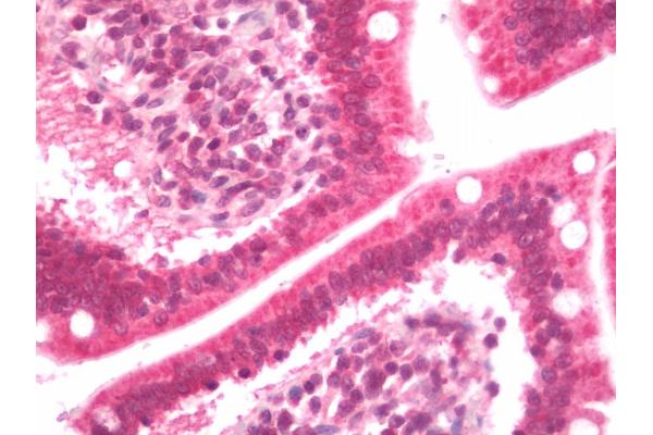 CSRP2BP antibody  (AA 21-319)