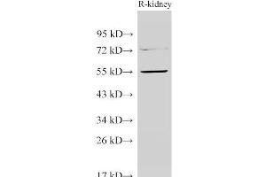 Western Blot analysis of Rat kidney using TGFBR1 Polyclonal Antibody at dilution of 1:1000 (TGFBR1 antibody)