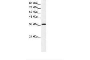Image no. 1 for anti-Kruppel-Like Factor 1 (erythroid) (KLF1) (AA 188-237) antibody (ABIN202347) (KLF1 antibody  (AA 188-237))