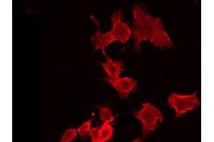 ABIN6272453 staining Hela by IF/ICC. (UBE3B antibody  (C-Term))