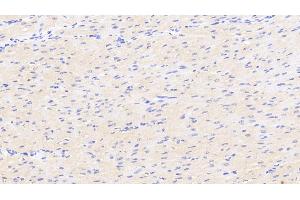 Detection of DKK2 in Human Cardiac Muscle Tissue using Polyclonal Antibody to Dickkopf Related Protein 2 (DKK2) (DKK2 antibody  (AA 159-258))