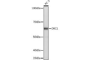 Western blot analysis of extracts of PC-3 cells, using DKC1 Rabbit mAb (ABIN7266869) at 1:1000 dilution. (DKC1 antibody)