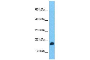 Western Blotting (WB) image for anti-Transcription Elongation Factor, Mitochondrial (TEFM) (N-Term) antibody (ABIN2506494) (TEFM antibody  (N-Term))