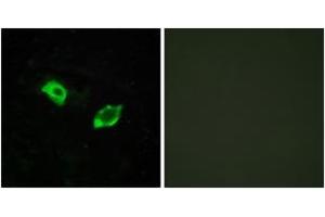 Immunofluorescence analysis of HuvEc cells, using GPR158 Antibody. (GPR158 antibody  (AA 1-50))
