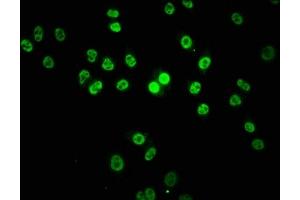 Immunofluorescence staining of Hela cells with ABIN7155462 at 1:133, counter-stained with DAPI. (Lysine (K)-Specific Methyltransferase 2B (KMT2B) (AA 145-290) antibody)