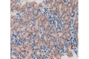 IHC-P analysis of kidney tissue, with DAB staining. (HSD17B12 antibody  (AA 1-312))