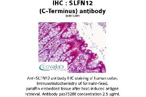 Image no. 2 for anti-Schlafen Family Member 12 (SLFN12) (C-Term) antibody (ABIN1739425) (SLFN12 antibody  (C-Term))