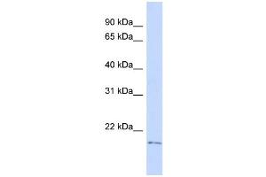 WB Suggested Anti-TGIF2LY Antibody Titration:  0. (TGIF2LY antibody  (Middle Region))
