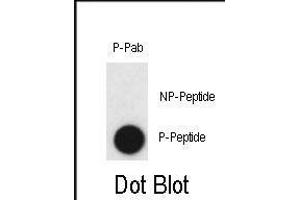 Dot blot analysis of anti-Phospho-CLDN2-p Antibody (ABIN390022 and ABIN2839781) on nitrocellulose membrane.