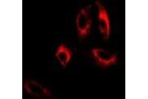 Immunofluorescent analysis of GAD2 staining in A549 cells. (GAD65 antibody)