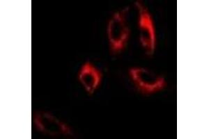 Immunofluorescent analysis of GAD2 staining in A549 cells. (GAD65 antibody)