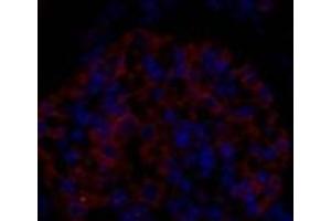Immunofluorescence analysis of Rat kidney tissue using EIF2 alpha Polyclonal Antibody at dilution of 1:200. (EIF2A antibody)