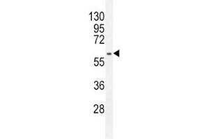 Western Blotting (WB) image for anti-Mdm2, p53 E3 Ubiquitin Protein Ligase Homolog (Mouse) (MDM2) (AA 393-424) antibody (ABIN3031739)