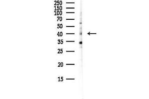 anti-Vaccinia Related Kinase 1 (VRK1) (Internal Region) antibody