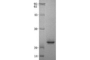 Validation with Western Blot (AGR2 Protein (His tag))