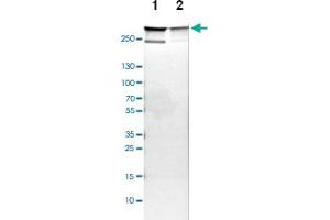 Western blot analysis of Lane 1: NIH-3T3 cell lysate (Mouse embryonic fibroblast cells), Lane 2: NBT-II cell lysate (Rat Wistar bladder tumour cells) with FLNA polyclonal antibody  at 1:100-1:500 dilution. (Filamin A antibody)