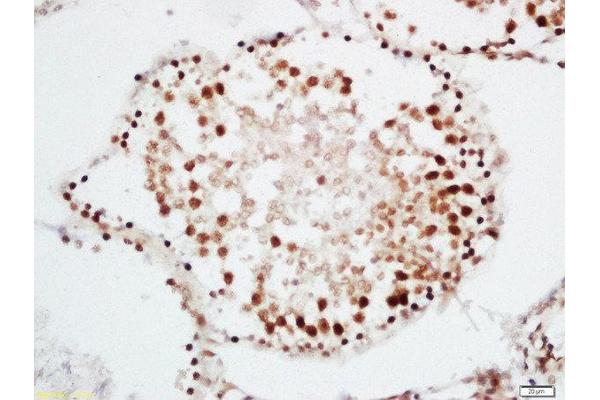 CRNKL1 antibody  (AA 201-300)
