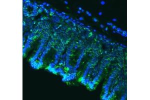 IF analysis of Claudin18/CLDN18 using anti-Claudin18/CLDN18 antibody (ABIN7601257). (Claudin 18 antibody  (AA 31-261))