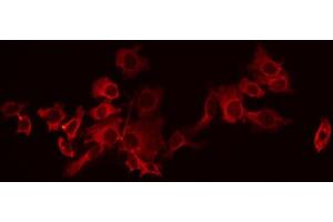 ABIN6266542 staining HeLa by IF/ICC. (GABBR1 antibody  (C-Term))