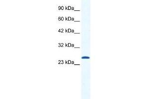 WB Suggested Anti-CACNG6 Antibody Titration:  1. (CACNG6 antibody  (N-Term))