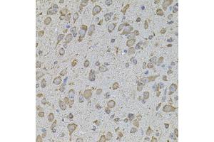Immunohistochemistry of paraffin-embedded mouse brain using COL1A2 antibody. (COL1A2 antibody)
