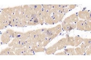 Detection of OPG in Human Cardiac Muscle Tissue using Polyclonal Antibody to Osteoprotegerin (OPG) (Osteoprotegerin antibody  (AA 1-196))