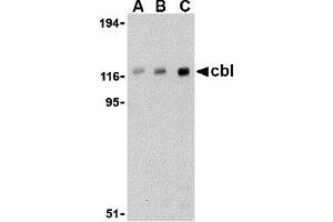 Western Blotting (WB) image for anti-Cas-Br-M (Murine) Ecotropic Retroviral Transforming Sequence (CBL) (C-Term) antibody (ABIN1030323) (CBL antibody  (C-Term))