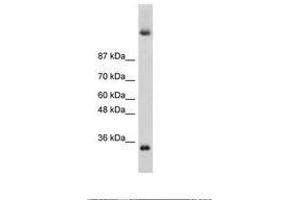 Image no. 3 for anti-Deleted In Azoospermia 4 (DAZ4) (N-Term) antibody (ABIN6736264) (DAZ4 antibody  (N-Term))