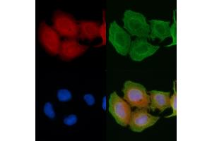 ABIN6256923 and ABIN6274414 staining Hela cells(45 min of heat-shock) by IF/ICC. (ADCK1 antibody  (Internal Region))