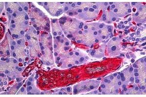 Rat Pancreas, Vessel: Formalin-Fixed, Paraffin-Embedded (FFPE) (RECA-1 antibody)