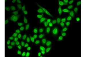 Immunofluorescence analysis of MCF-7 cells using RanG antibody (ABIN6128613, ABIN6146681, ABIN6146683 and ABIN6217306). (RANGAP1 antibody  (AA 398-587))