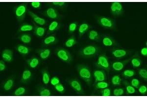 Immunofluorescence analysis of A549 cells using POLR2J Polyclonal Antibody (POLR2J antibody)