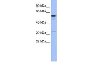 Image no. 1 for anti-Zinc Finger Protein 146 (ZNF146) (AA 143-192) antibody (ABIN6742606) (ZNF146 antibody  (AA 143-192))