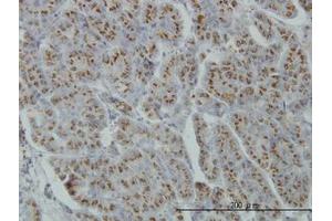 Image no. 1 for anti-Mannosyl (Alpha-1,3-)-Glycoprotein beta-1,4-N-Acetylglucosaminyltransferase, Isozyme A (MGAT4A) (AA 436-536) antibody (ABIN599178) (MGAT4A antibody  (AA 436-536))