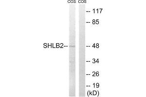 Western Blotting (WB) image for anti-SH3-Domain GRB2-Like Endophilin B2 (SH3GLB2) (Internal Region) antibody (ABIN1852154) (SH3GLB2 antibody  (Internal Region))
