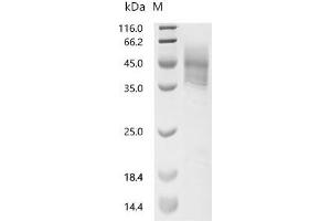 (Tris-Glycine gel) Discontinuous SDS-PAGE (reduced) with 5 % enrichment gel and 15 % separation gel.