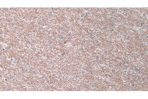 Detection of ELA1 in Human Cerebrum Tissue using Polyclonal Antibody to Pancreatic Elastase 1 (ELA1) (CELA1 antibody  (AA 40-258))