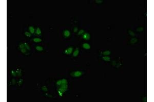 Immunofluorescent analysis of HepG2 cells using ABIN7145824 at dilution of 1:100 and Alexa Fluor 488-congugated AffiniPure Goat Anti-Rabbit IgG(H+L) (BRD9 antibody  (AA 338-597))