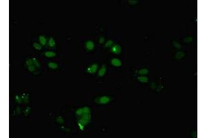 Immunofluorescent analysis of HepG2 cells using ABIN7145824 at dilution of 1:100 and Alexa Fluor 488-congugated AffiniPure Goat Anti-Rabbit IgG(H+L) (BRD9 antibody  (AA 338-597))