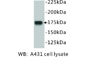 Image no. 1 for anti-Epidermal Growth Factor Receptor (EGFR) antibody (ABIN1112884)