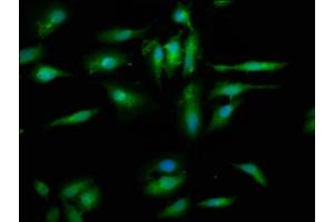 Immunofluorescence staining of Hela cells with ABIN7152365 at 1:200, counter-stained with DAPI. (EYA4 antibody  (AA 153-224))