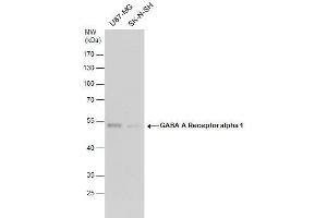 WB Image GABA A Receptor alpha 1 antibody detects GABA A Receptor alpha 1 protein by western blot analysis. (GABRA1 antibody  (Center))