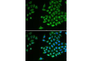 Immunofluorescence analysis of MCF-7 cell using PTPN2 antibody. (PTPN2 antibody)