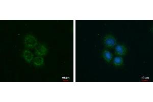 ICC/IF Image ROCK2 antibody detects ROCK2 protein at cytoplasm by immunofluorescent analysis.